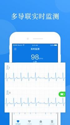 AI ECG1