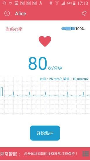 SMART ECG2