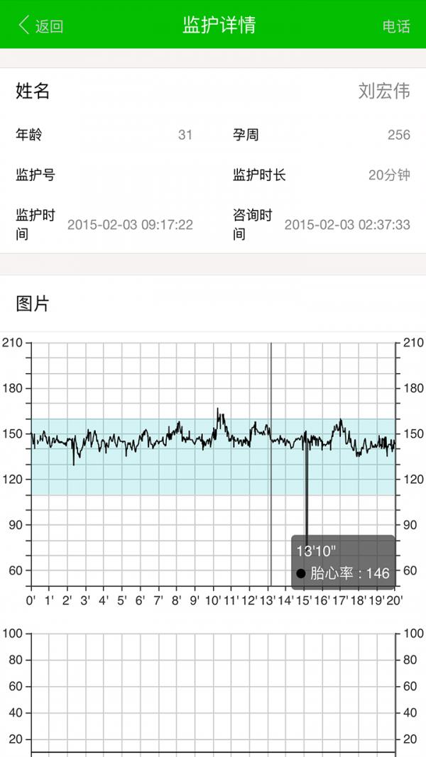 易胎心医生版2