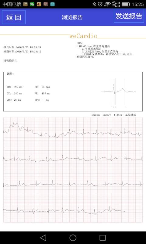 四维心电在线5