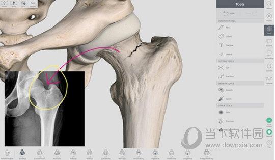 Complete Anatomy