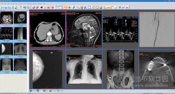 Sante DICOM Viewer中文版 V11.8.8 免费版