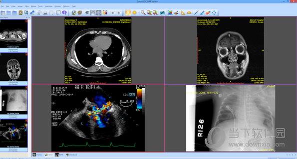 Sante DICOM Viewer