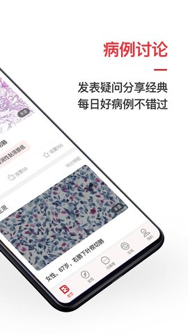 爱病理app 3.6.12 安卓版1