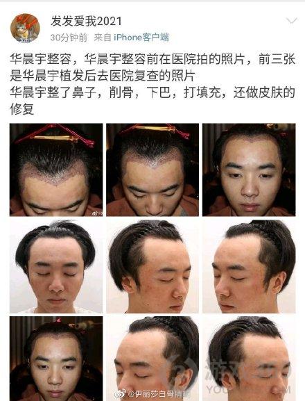 华晨宇整容怎么回事 张碧晨插足恋情